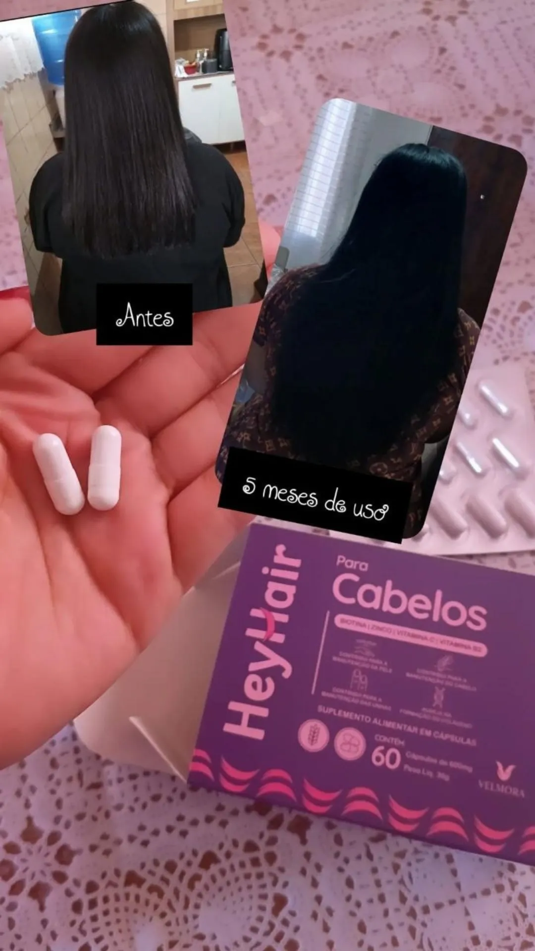 Entrega e Avaliação Velmo Caps